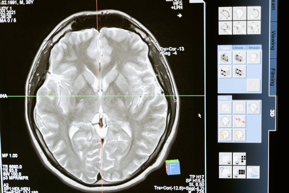 Addressing Radiation Exposure: Understanding VA Radiation Exposure Claims